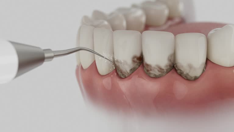 Reliable Dental Implants contractor in Arnold Line, MS by Smile Center Dentistry
